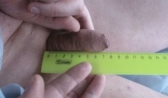 Измерване на размера на пениса